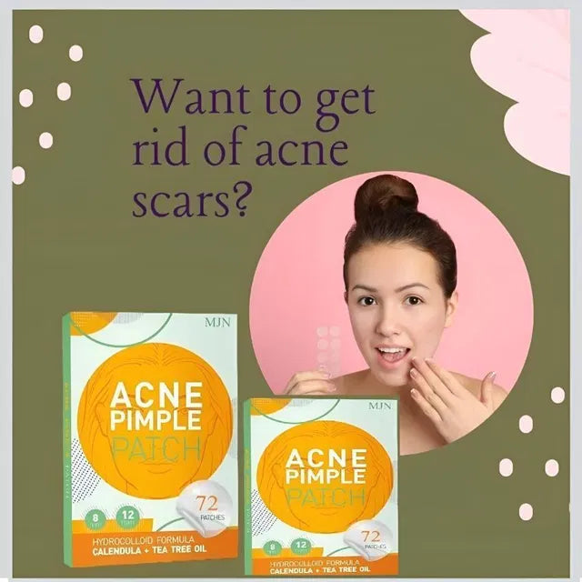 Acne Clearing Pimple Patches (Pack of 2) - 144 Patches